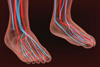 Peripheral Arterial Disease