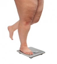 Foot Conditions and Obesity