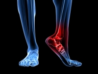 What Heel Pain Can Tell You